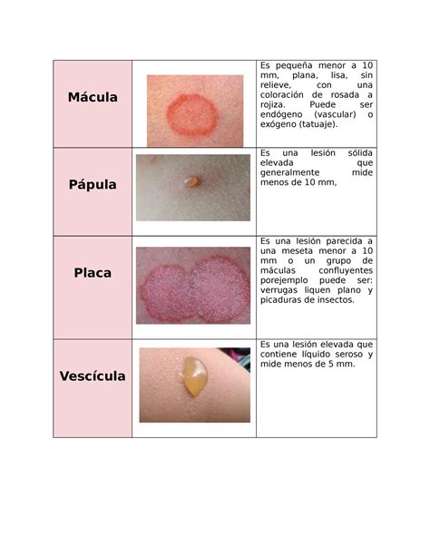 macula piel - descamación de la piel